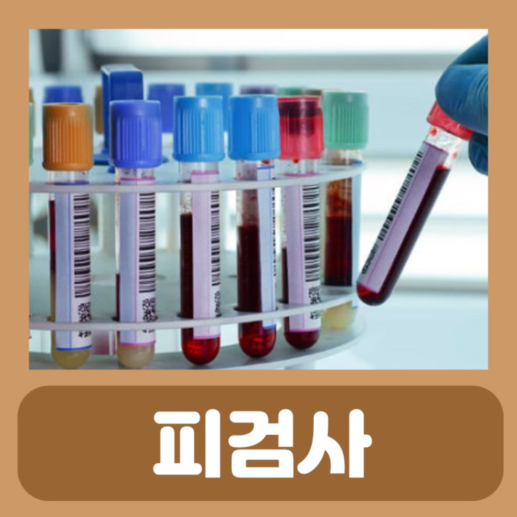  피검사 금식시간 보건소 피검사로 알수있는것 피검사 혈액검사