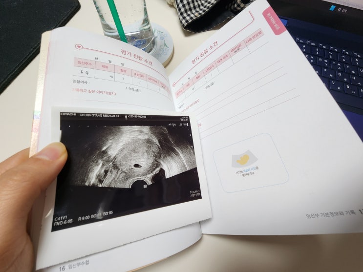 임산부에게 안전한 약 임신 중 먹어도 되는 약?