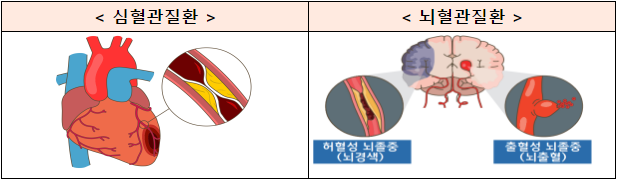 네트워크를 통한 중증·응급 심뇌혈관질환 적시 치료 강화(제2차 심뇌혈관질환관리 종합계획(´23~´27) 발표) 네트워크를 통한 중증·응급 심뇌혈관질환 적시 치료 강화(제2차 심뇌혈관질환관리 종합계획(´23~´27) 발표)