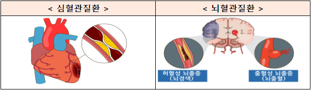 네트워크를 통한 중증·응급 심뇌혈관질환 적시 치료 강화(제2차 심뇌혈관질환관리 종합계획(´23~´27) 발표)