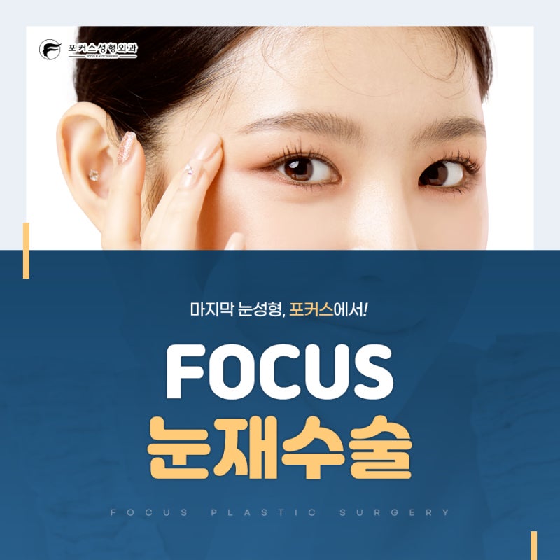 포커스성형외과, '소세지눈'피하라면?
