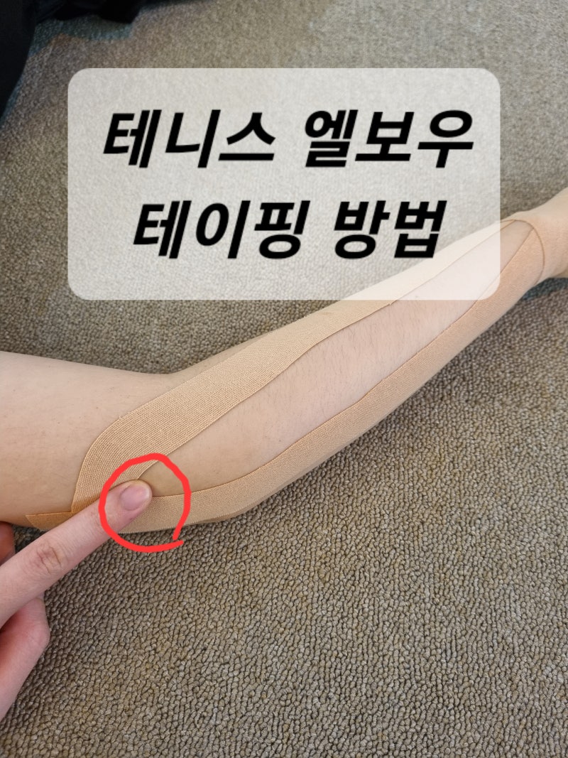 손동작이 뻣뻣한 테니스엘보 스포츠 테이핑 방법