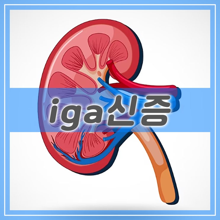  사구체신염과 IGA신증, 증상과 검사 방법