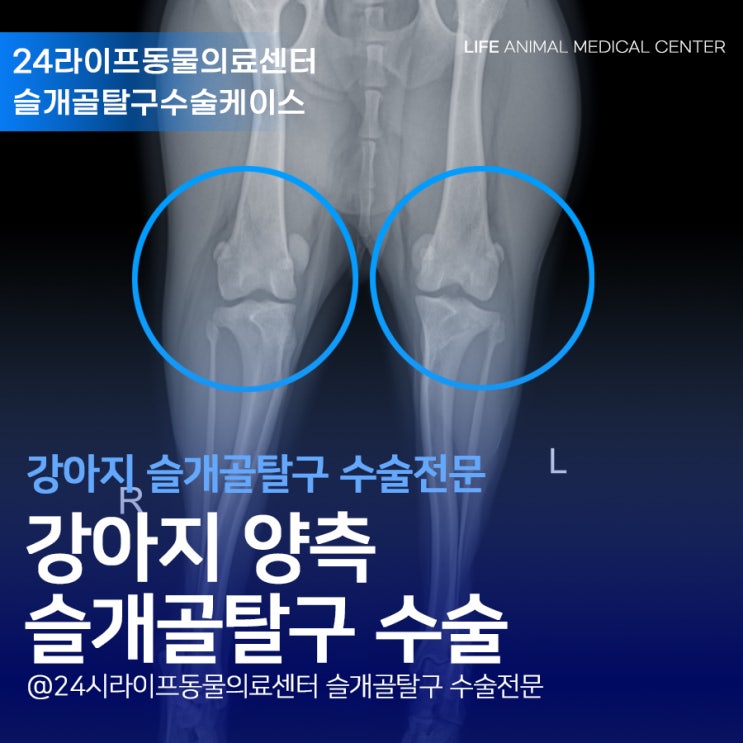 대구강아지슬개골탈구수술 2달간의 치료기록 : 경산 사는 푸들 강아지 슬개골탈구 수술 대구강아지슬개골탈구수술 2달간의 치료기록 : 경산 사는 푸들 강아지 슬개골탈구 수술