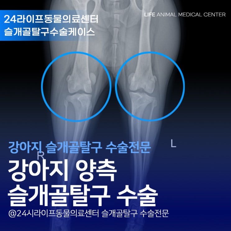 대구강아지슬개골탈구수술 2달간의 치료기록 : 경산 사는 푸들 강아지 슬개골탈구 수술