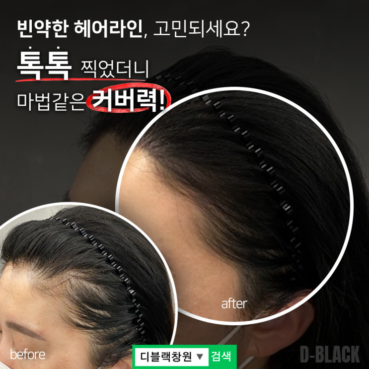  창원 헤어디자인 잘 하는곳! 마법같은 커버로 헤어라인 완성