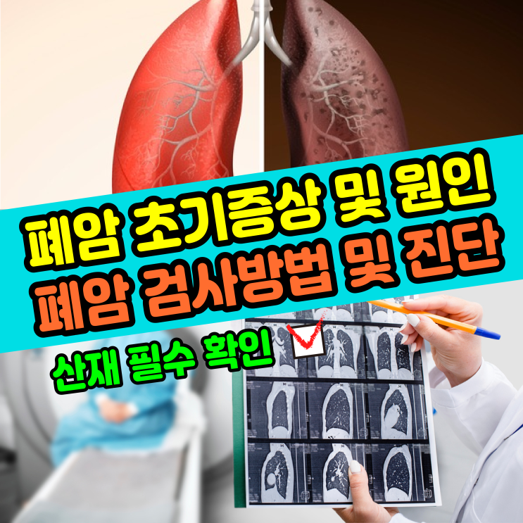  [건강정보] 폐암 초기증상 및 원인 / 폐암 검사방법 및 진단 병기별 치료 / 산재보험 확인
