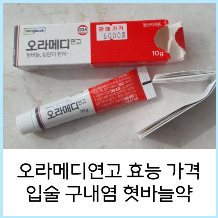  오라메디 연고 효능 가격 입술 구내염 혓바늘약