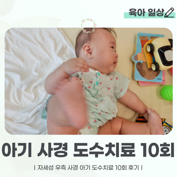 두상 비대칭 기운목 아기 사경 도수치료 10 회 변화(경과)