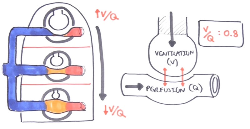 V/Q mismatch 환기관류 공부하기 : 네이버 블로그