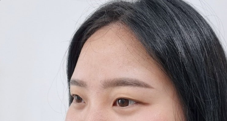  쌍촌동눈썹문신 스트레스였던 비대칭 잔흔