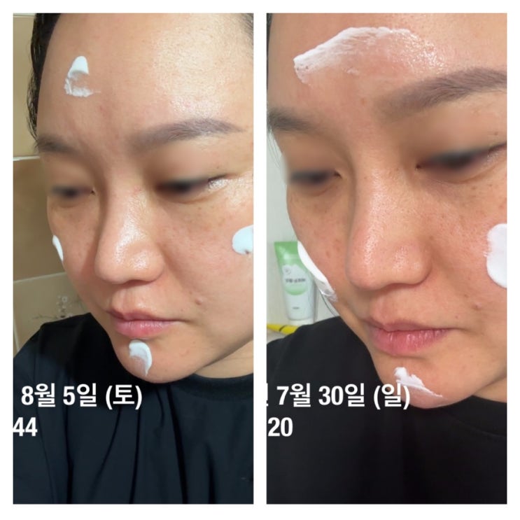  라로슈포제 시카플라스트 밤B5+ 시카플라스트멀티리페어크림 리뷰
