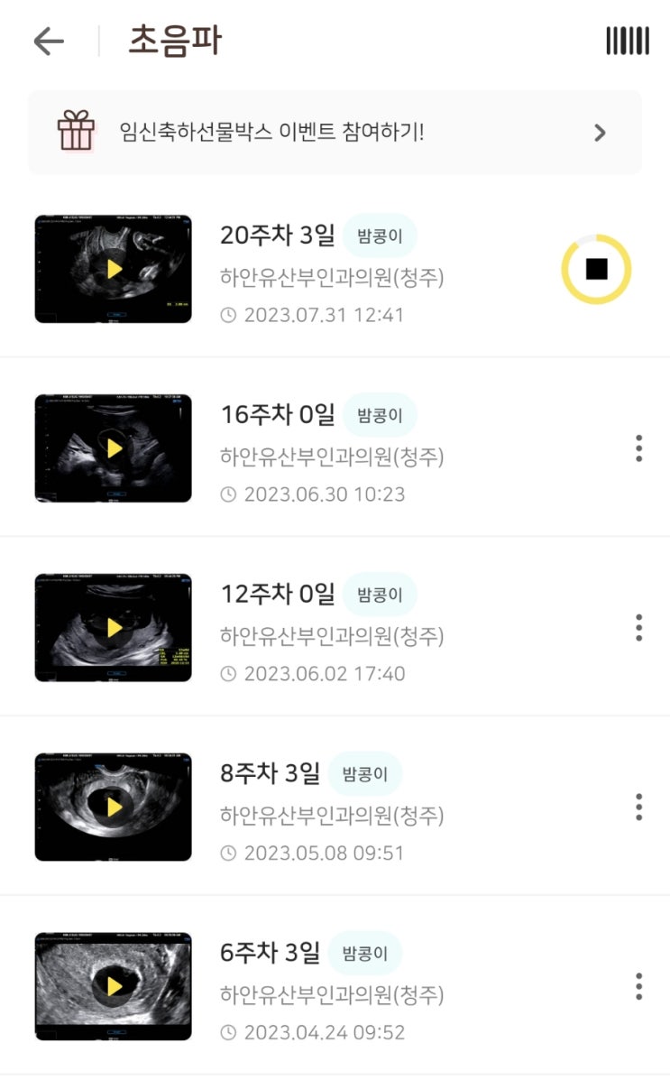  임신 18 19 20주차별 증상 사진 영상