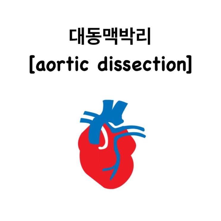  [대동맥박리] 가슴과 등 통증이 있다면 의심해볼 수 있는 질환