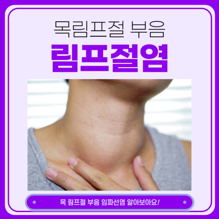  급성 림프절염 목 림프절 부음 목에 멍울 혹 원인