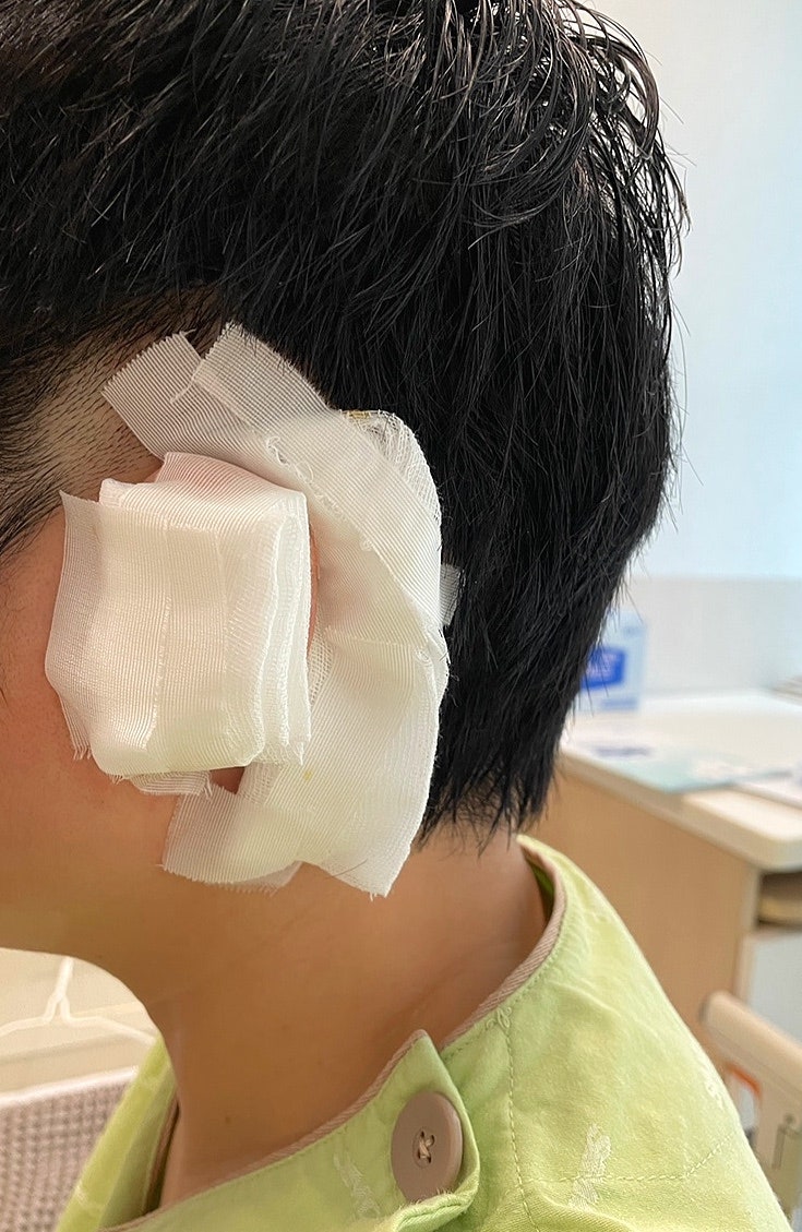 중이염 고막천공 수술 후기(3): 삼성서울병원 퇴원, 수술 및 입원료 총정리