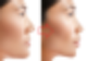 뮤잉(Mewing) 운동 제대로 하는 방법과 효과, 부작용과 주의사항 : 네이버 블로그