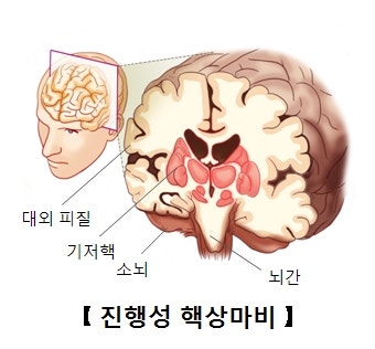 기저핵(Basal nucleus)과 선조체(Striatum) : 네이버 블로그