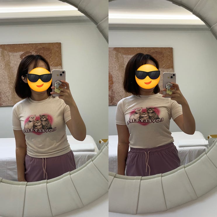  동대문 제기동 마사지 최박사몸신 어깨깡패 됐던 체형교정 후기