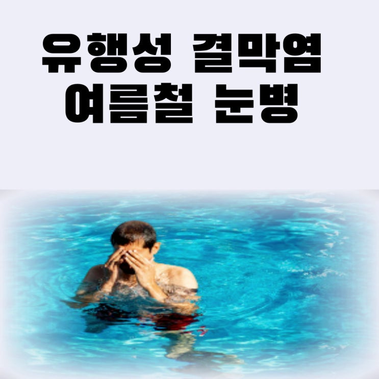  유행성 결막염 전염 증상 원인 치료 여름철 눈병 예방