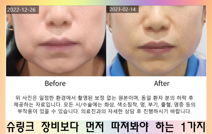 동탄슈링크 노화와 주름 개선에 효과적인 방법