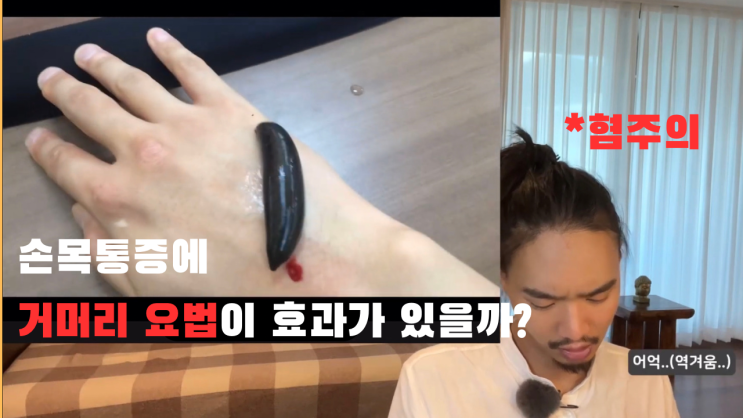  손목통증에 거머리 요법이 도움이 될까?