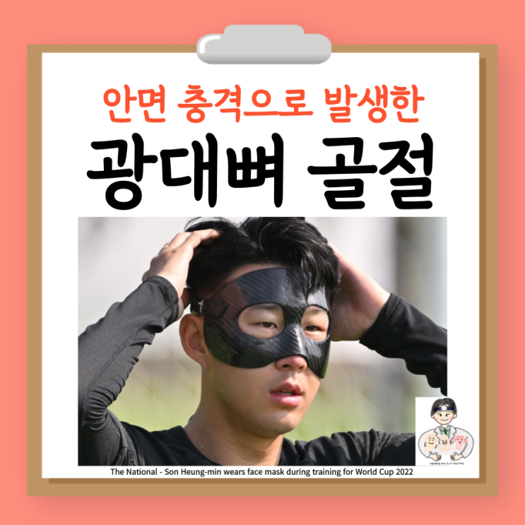  광대뼈 골절 원인 증상 검사 치료 수술