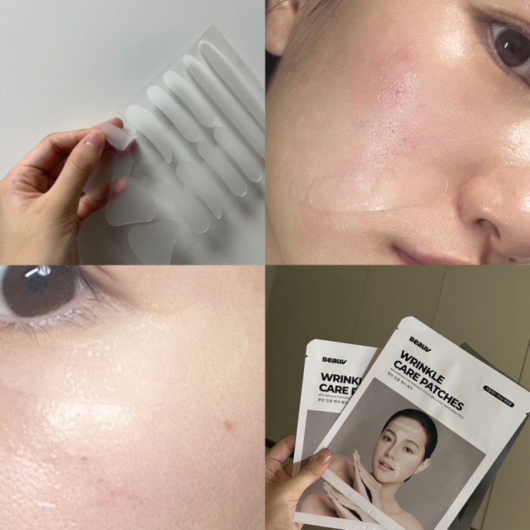  눈가 이마 팔자주름 없애는법 뷰브 리프팅 주름패치 사용하기