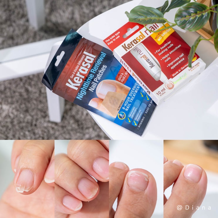 변색 발톱 손톱 세로줄 영양제 케라셀 네일 강화제 관리해요 변색 발톱 손톱 세로줄 영양제 케라셀 네일 강화제 관리해요