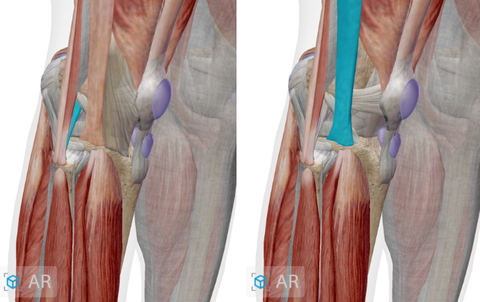 [무릎 초음파] Lateral knee (Iliotibial band, Lateral collateral ligament ...
