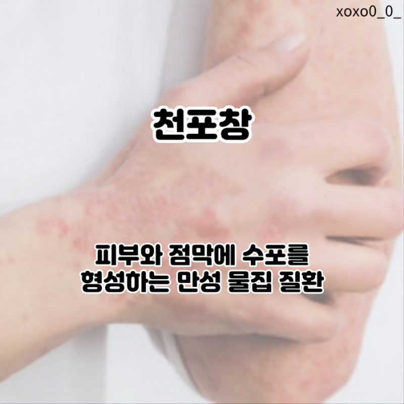 천포창: 증상 및 치료