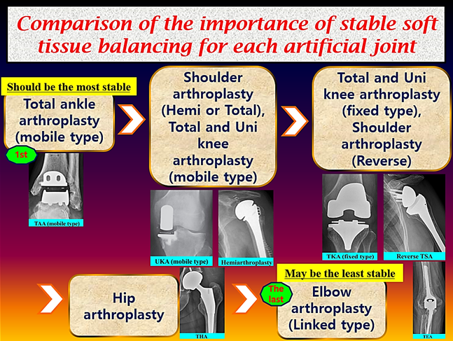 3-8② 수술 중 단계, 인공관절의 만족도는 soft tissue balancing에 달려있다!