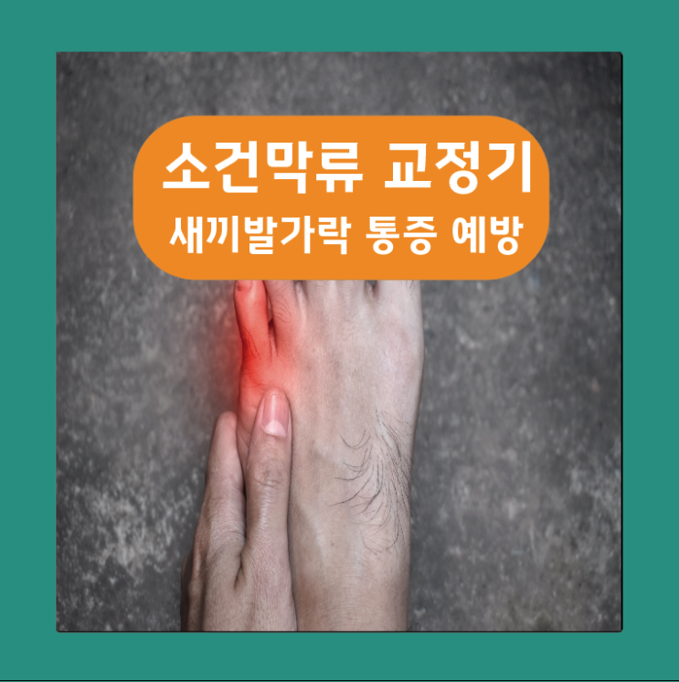  왼쪽 새끼발가락통증 소건막류 교정기