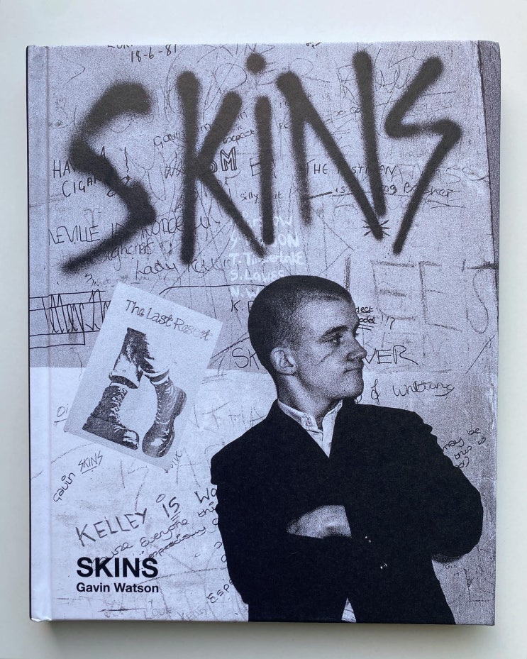  Gavin Watson: Skins