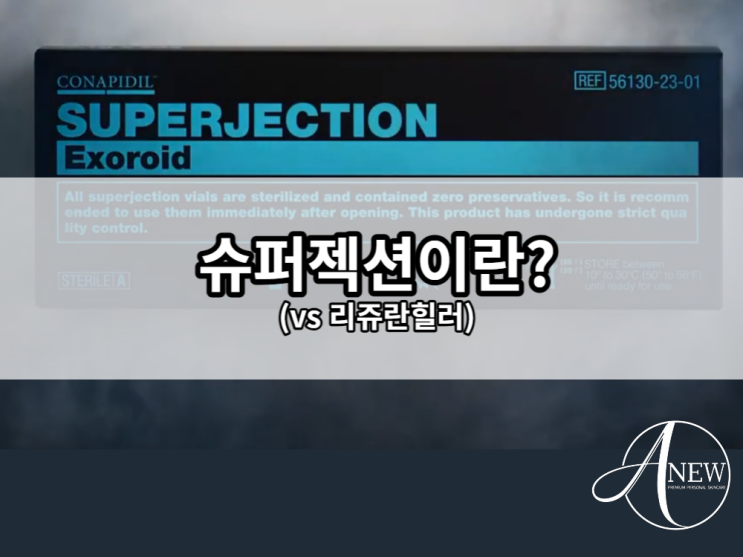  슈퍼젝션 입점? 멘토마다 혜택이 다른 3가지 이유