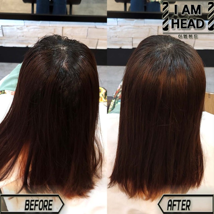  납작한 두상을 봉긋하게 만드는 모류교정펌