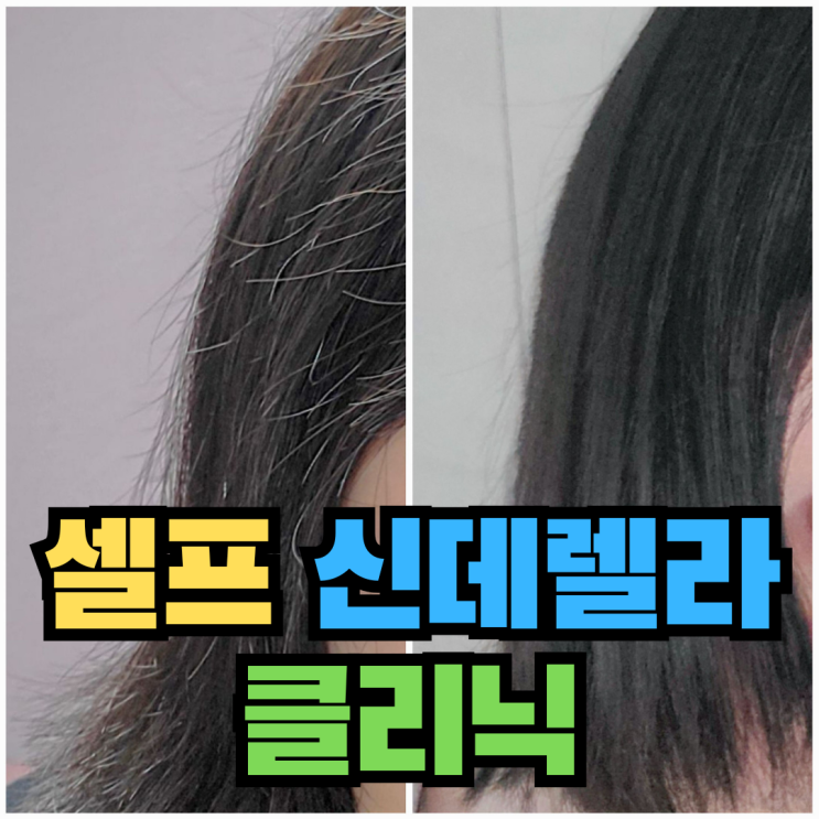  [미용] 셀프 신데렐라 클리닉 매직 머리 상한머리 반곱슬 하는법 주의사항