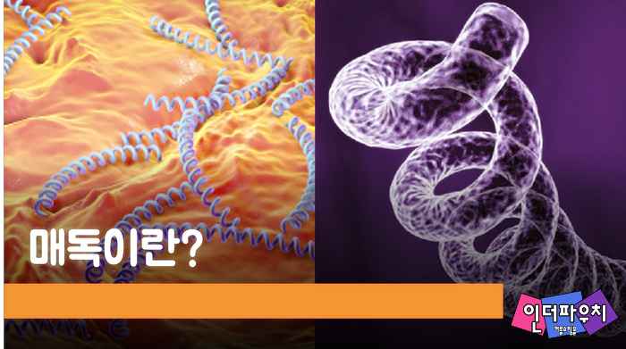  일본에서 급증한 매독 뜻 원인 초기 증상 치료(성병예방)