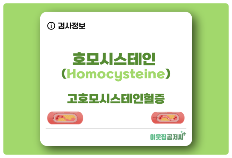 호모시스테인 Homocysteine 검사 및 수치 고호모시스테인혈증