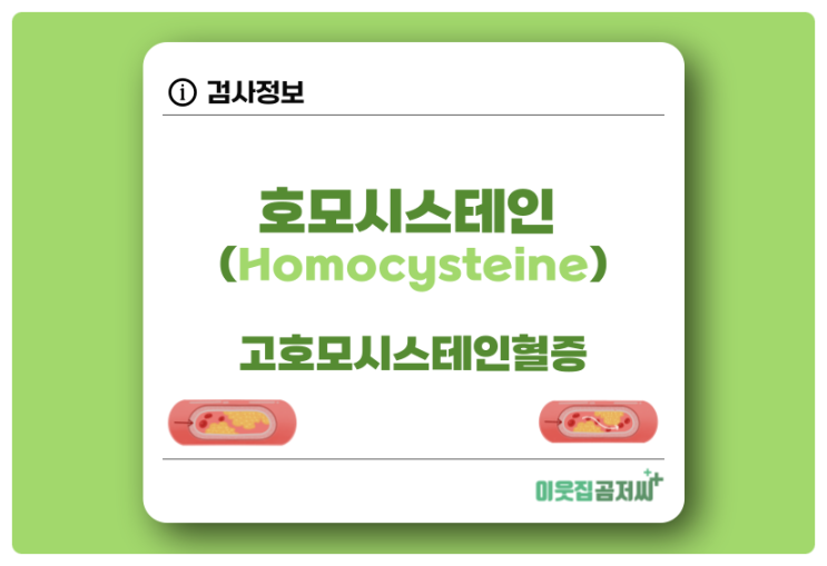  호모시스테인 Homocysteine 검사 및 수치 고호모시스테인혈증