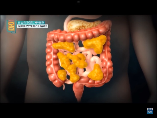  내장지방있는 복부비만일수록 굶지마! 하루3끼 다 먹어야해!