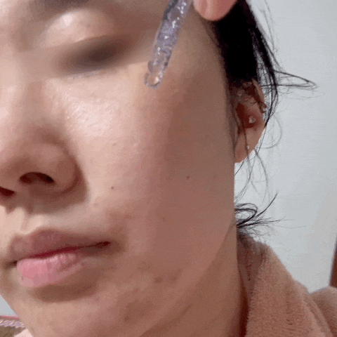  루시마마 여드름앰플 성인 기미, 여드름화장품 추천