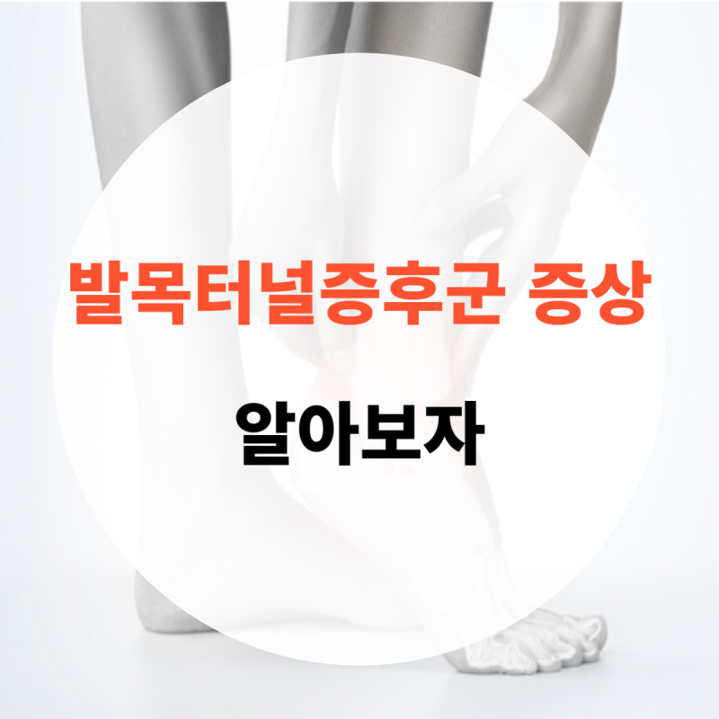 발목터널증후군 증상 알아보자