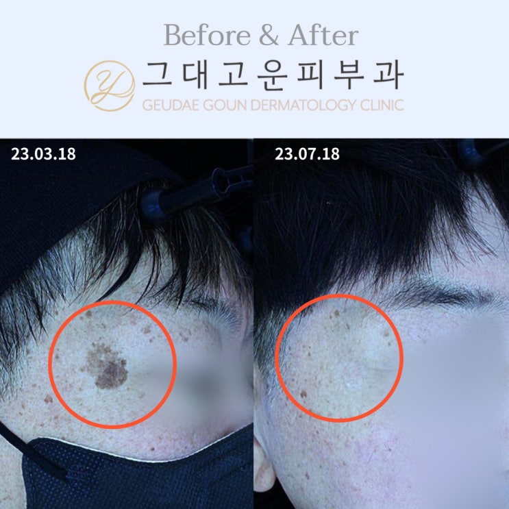 장산 피부과 실력의 차이는 '이곳'에서 납니다. 장산 피부과 실력의 차이는 '이곳'에서 납니다.