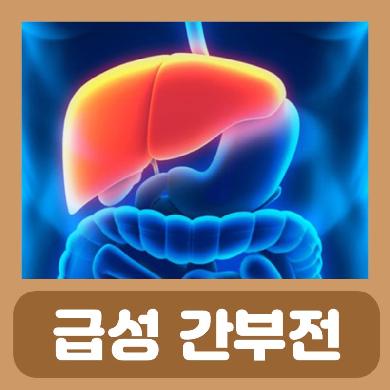 간기능 저하 증상 급성 간부전 원인 증상
