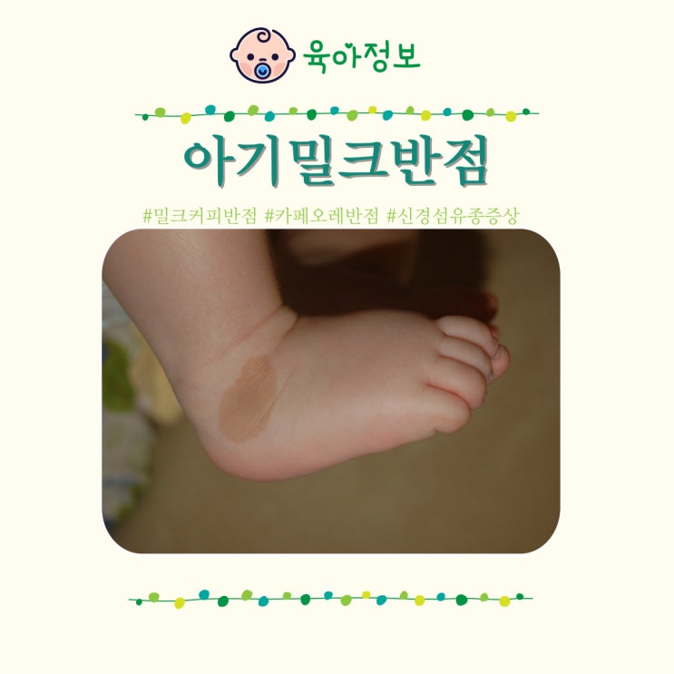  아기밀크반점 신경섬유종 카페오레 밀크커피반점 원인 치료