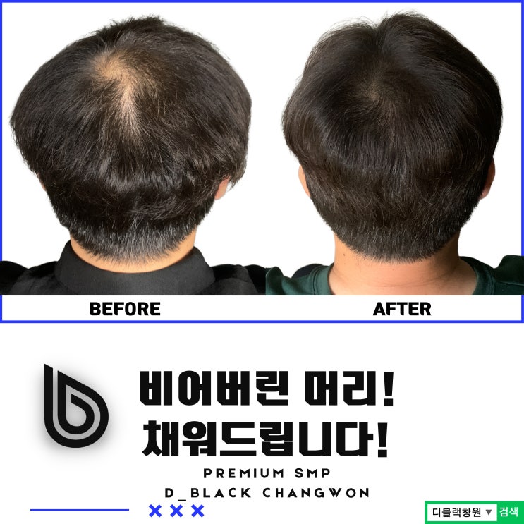  창원헤어디자인 잘 하는곳에서 젊음을 되찾다! #창원두피문신 #창원디블랙