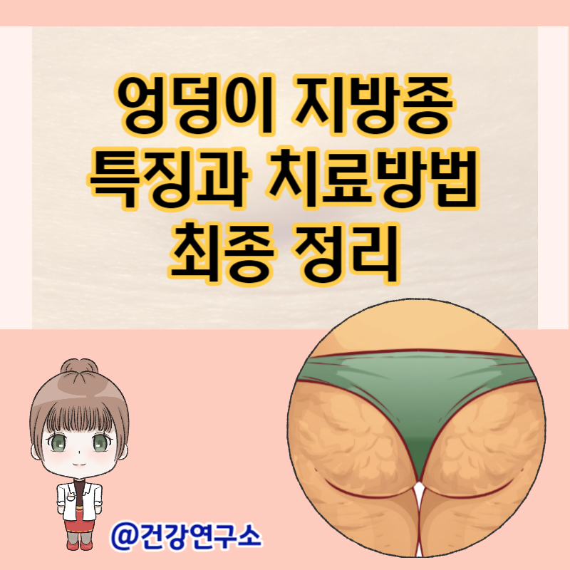엉덩이 지방종 특징과 치료방법 최종 정리