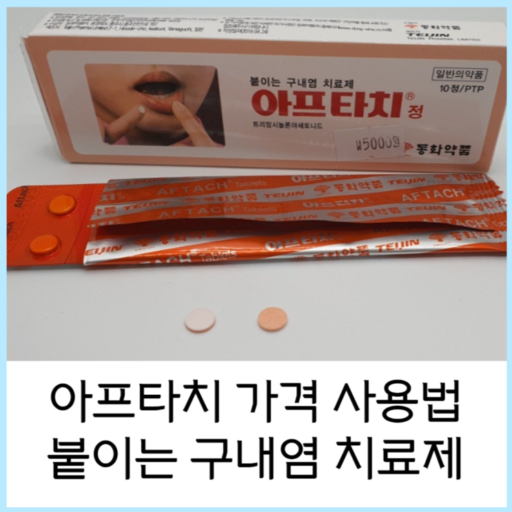  아프타치 효능 붙이는 구내염 치료제 가격 사용법