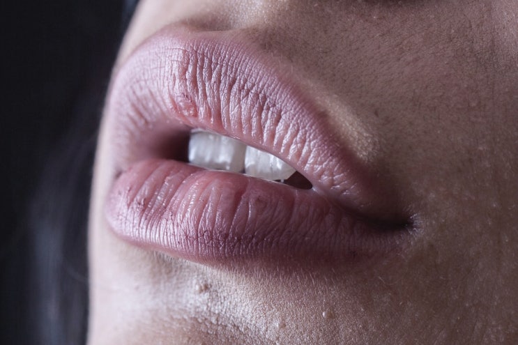  입술 뜯는 버릇과 껍질 관리, 그 뒤에 숨겨진 진실 (스트레스 해소 방법)